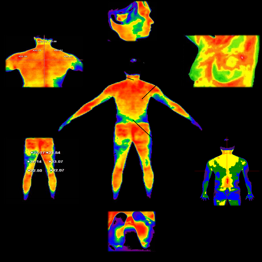 Digital Infrared Thermal Imaging System