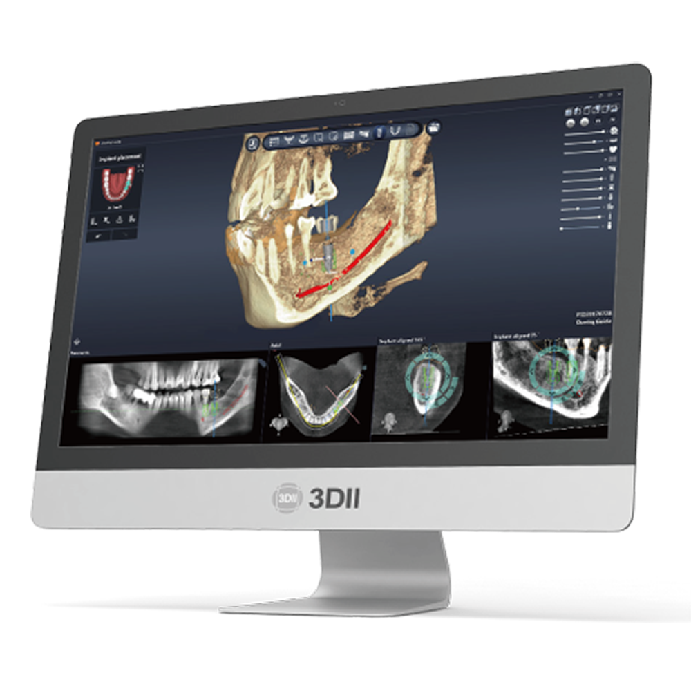 [3D Industrial] DentiqGuide