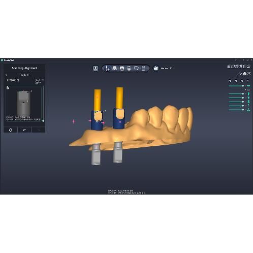 [3D Industrial] DentiqAbut